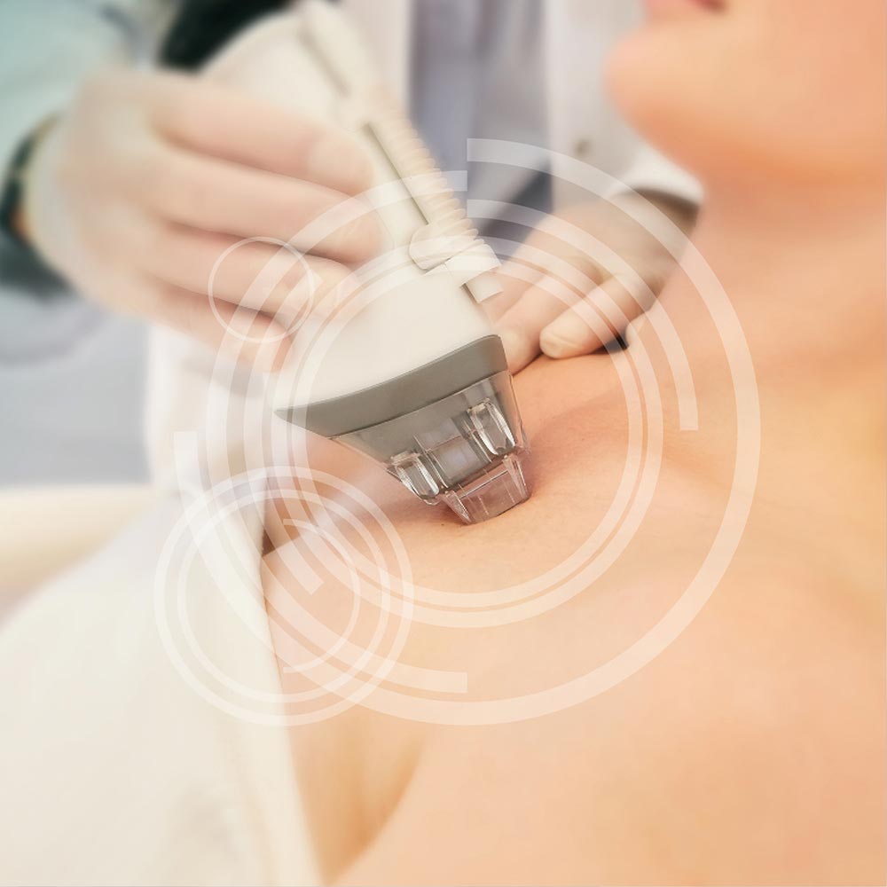 Fraxel - MKG-Chirurgie Erfurt Fraxel - MKG-Chirurgie Erfurt