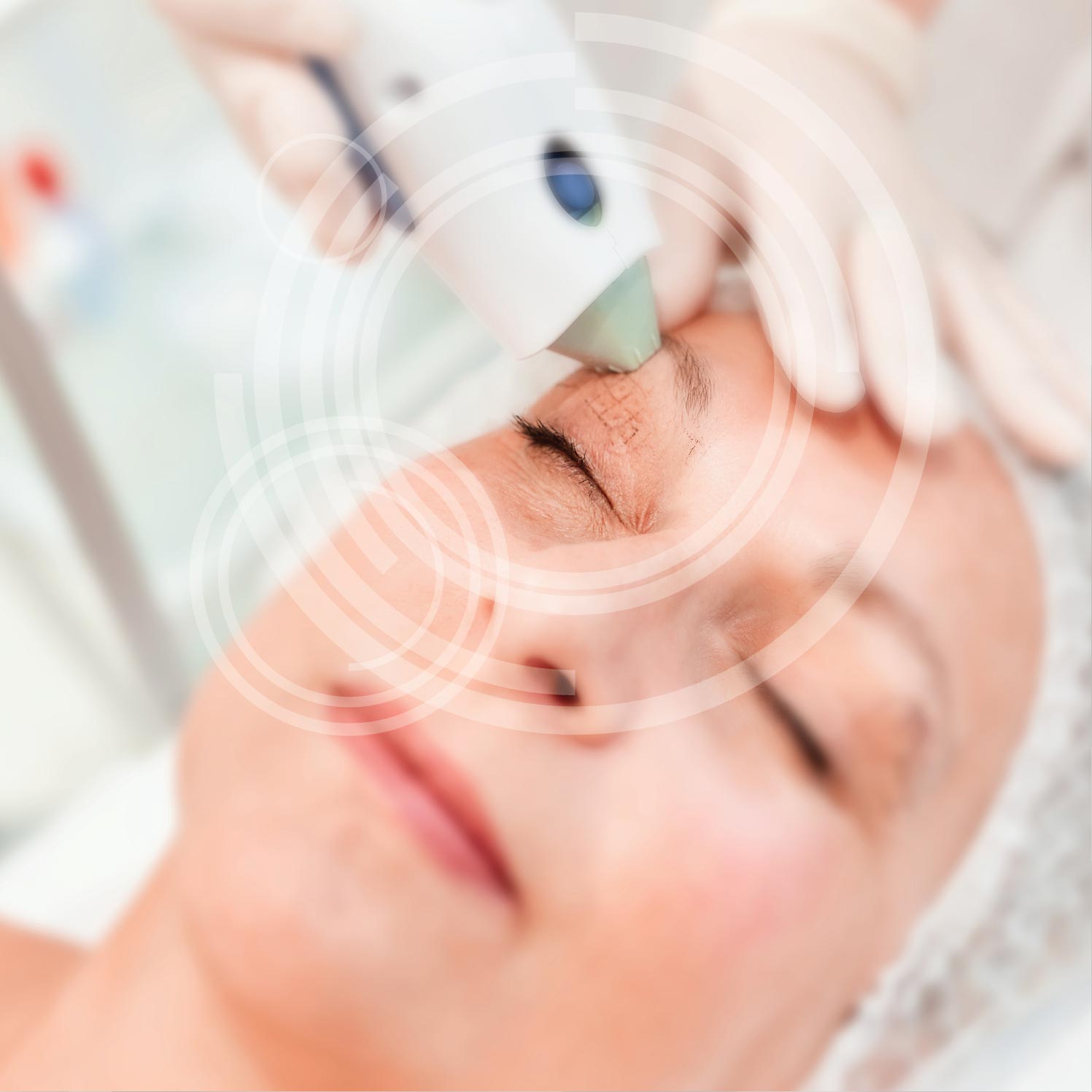 Thermage - MKG-Chirurgie Erfurt Thermage - MKG-Chirurgie Erfurt