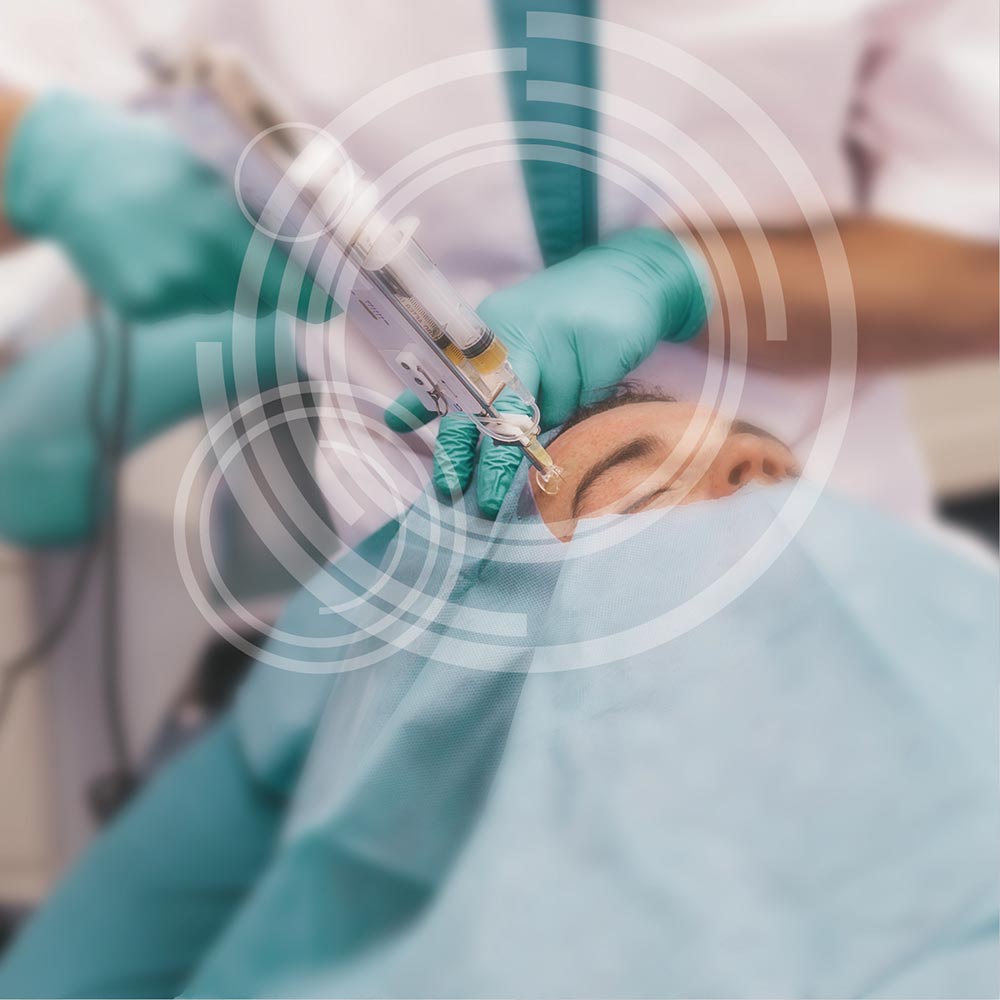 PRP-Needling / Vampirlifting - MKG-Chirurgie Erfurt PRP-Needling / Vampirlifting - MKG-Chirurgie Erfurt