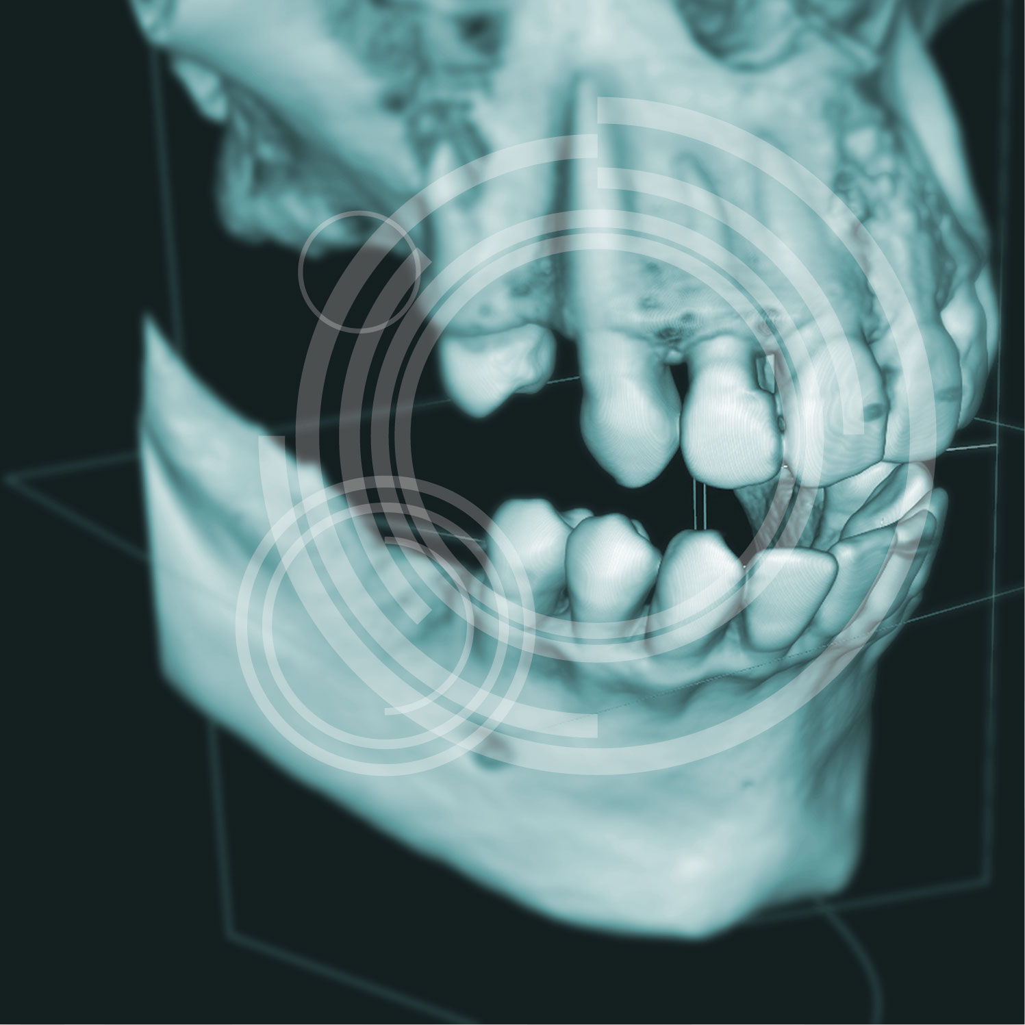 3D Röntgendiagnostik - MKG-Chirurgie Erfurt 3D Röntgendiagnostik - MKG-Chirurgie Erfurt